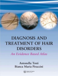 صورة الغلاف: Diagnosis and Treatment of Hair Disorders 1st edition 9781841843407