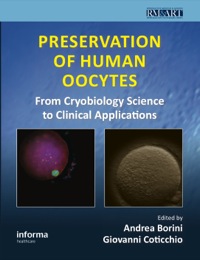 Cover image: Preservation of Human Oocytes 1st edition 9780415476799