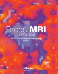 Imagen de portada: Breast MRI in Practice 1st edition 9781841841373