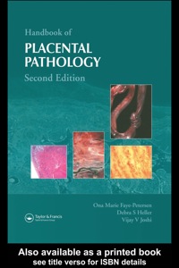 表紙画像: Handbook of Placental Pathology 2nd edition 9781842142325