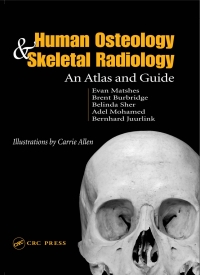 Cover image: Human Osteology and Skeletal Radiology 1st edition 9780849319013