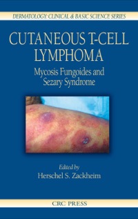 Cover image: Cutaneous T-Cell Lymphoma 1st edition 9780367393670