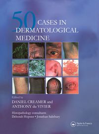 صورة الغلاف: Fifty Dermatological Cases 1st edition 9780367393441