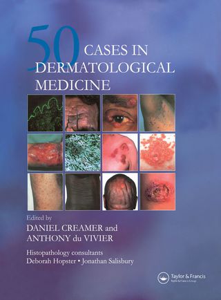 Cover image: Fifty Dermatological Cases 1st edition 9780367393441