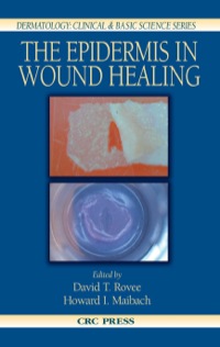 صورة الغلاف: The Epidermis in Wound Healing 1st edition 9780849315619