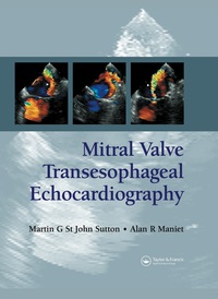 Titelbild: Mitral Valve Transesophageal Echocardiography 1st edition 9780367446420