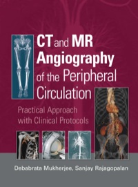 Cover image: CT and MR Angiography of the Peripheral Circulation 1st edition 9780367389062