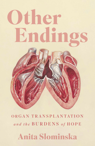 Titelbild: Other Endings 9780228027195