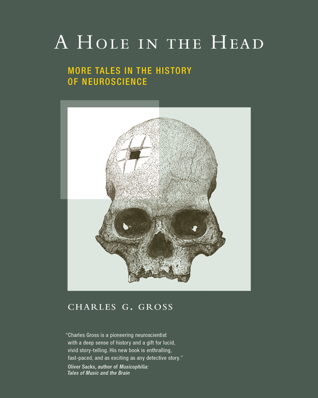 A Hole in the Head More Tales in the History of Neuroscience