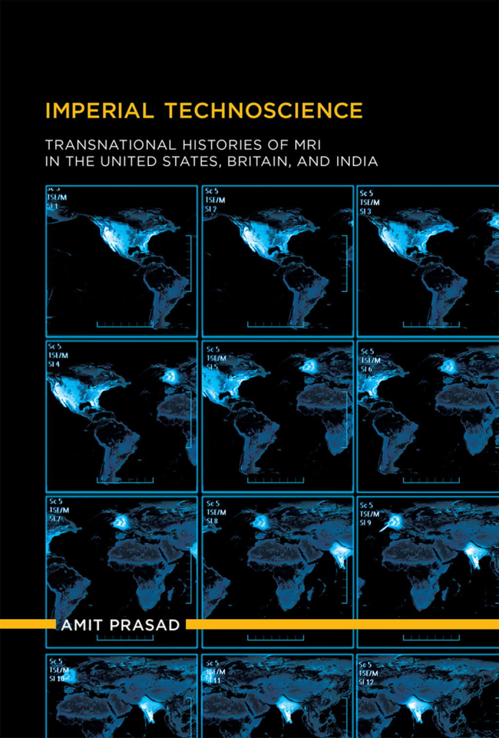 Imperial Technoscience Transnational Histories of MRI in the United States, Britain, and India