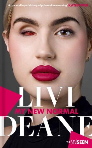 Cover image: My New Normal 1st edition 9780281088072