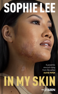 Cover image: In My Skin 1st edition 9780281089406