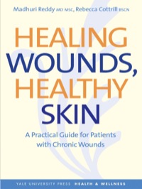 Cover image: Healing Wounds, Healthy Skin: A Practical Guide for Patients with Chronic Wounds 9780300171006