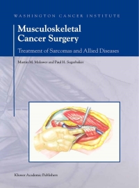 Cover image: Musculoskeletal Cancer Surgery 1st edition 9780792363941