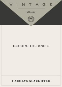Cover image: Before the Knife 9780375713460