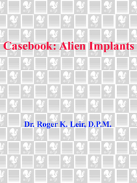 Cover image: Casebook: Alien Implants 9780440236412