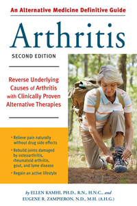 Cover image: An Alternative Medicine Guide to Arthritis 9781587612589
