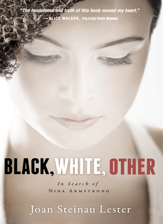 Cover image: Black, White, Other 9780310761518
