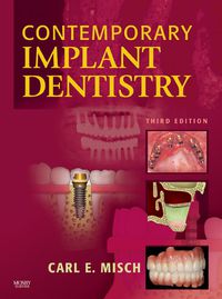 Cover image: Contemporary Implant Dentistry, 3rd Edition 3rd edition 9780323043731