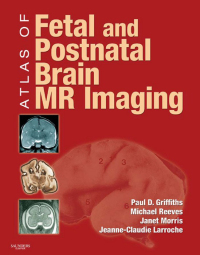 Cover image: Atlas of Fetal and Postnatal Brain MR 9780323052962