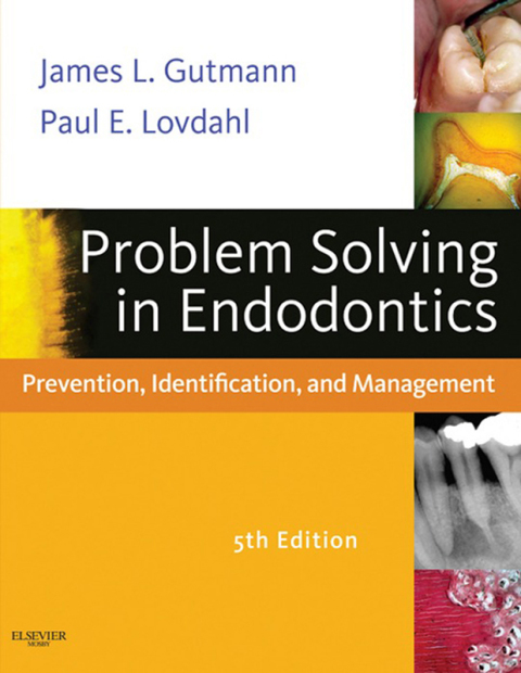 Problem Solving in Endodontics: Prevention, Identification and Management, 5th Edition - FULL INSTANT DOWNLOAD | PDF DOCX EPUB