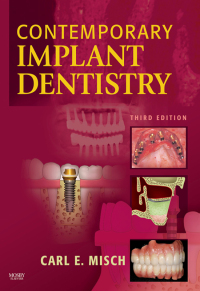 Cover image: Contemporary Implant Dentistry 3rd edition 9780323043731
