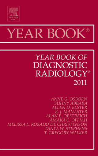 Immagine di copertina: Year Book of Diagnostic Radiology 2011 9780323084116
