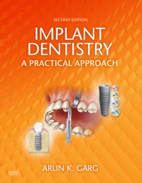 Omslagafbeelding: Implant Dentistry 2nd edition 9780323055666