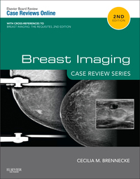 صورة الغلاف: Breast Imaging: Case Review Series 2nd edition 9780323087223