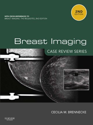 Cover image: Breast Imaging: Case Review Series 2nd edition 9780323087223