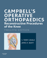 Cover image: Campbell's Operative Orthopaedics: Reconstructive Procedures of the Knee 12th edition 9780323101356