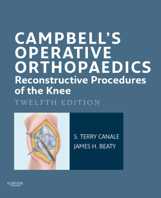 Cover image: Campbell's Operative Orthopaedics: Reconstructive Procedures of the Knee 12th edition 9780323101356