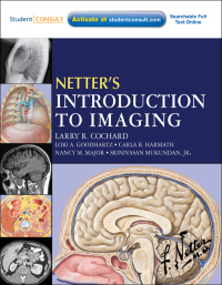 Cover image: Netter's Introduction to Imaging 9781437707595