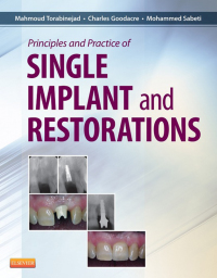 Imagen de portada: Principles and Practice of Single Implant and Restoration 9781455744763