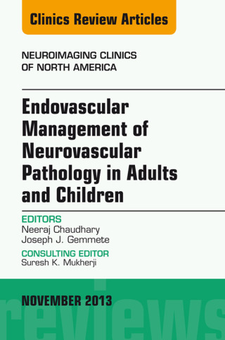 Imagen de portada: Endovascular Management of Neurovascular Pathology in Adults and Children, An Issue of Neuroimaging Clinics 9780323242318