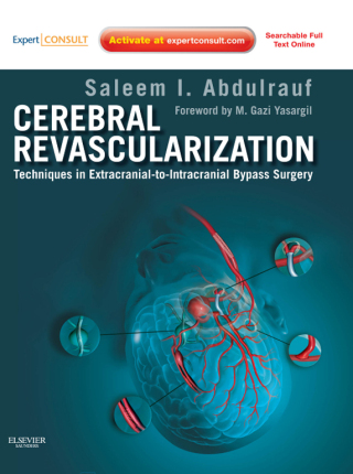 صورة الغلاف: Cerebral Revascularization 1st edition 9781437717853