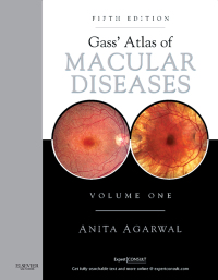 صورة الغلاف: Gass' Atlas of Macular Diseases 5th edition 9781437715804