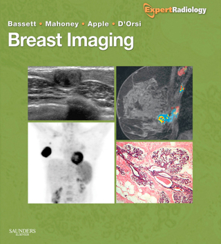 Cover image: Breast Imaging: Expert Radiology Series 1st edition 9781416051992