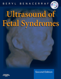 Immagine di copertina: Ultrasound of Fetal Syndromes - Electronic 2nd edition 9780443066412