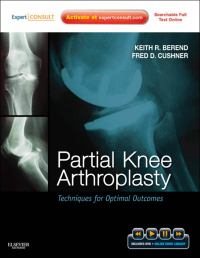 Titelbild: Partial Knee Arthroplasty 1st edition 9781437717563