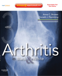Cover image: Arthritis in Black and White E-Book 3rd edition 9781416055952