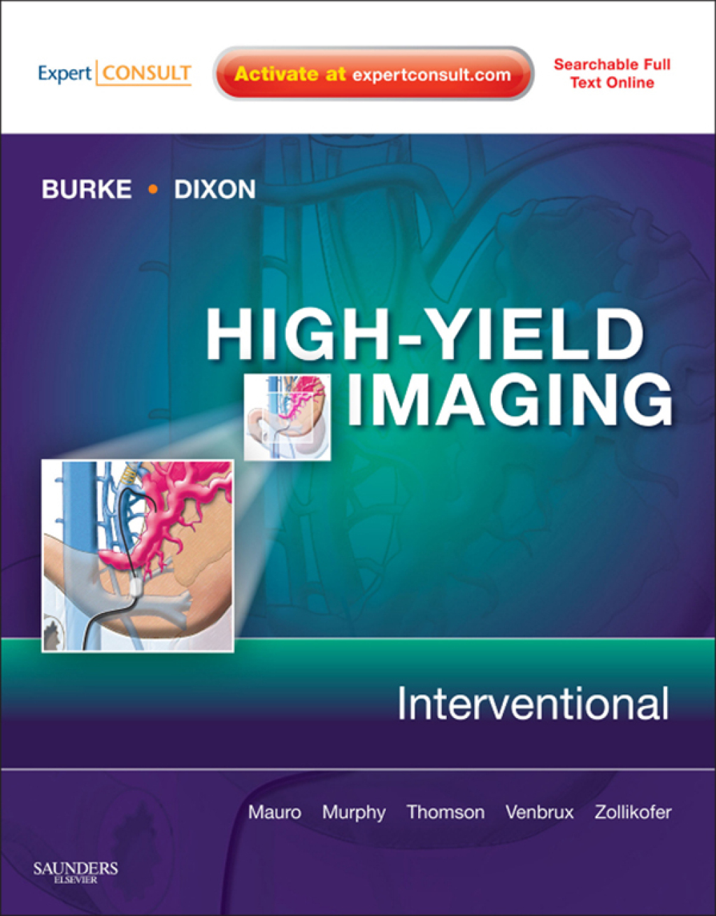 High-Yield Imaging: Interventional – Electronic 1st Edition