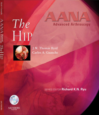 表紙画像: AANA Advanced Arthroscopy: The Hip 1st edition 9781437709117