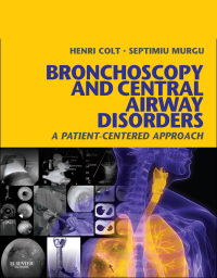 Cover image: Bronchoscopy and Central Airway Disorders 9781455703203