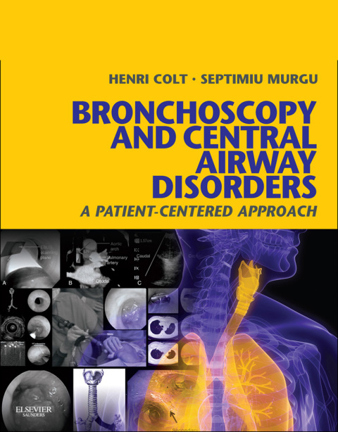 Bronchoscopy and Central Airway Disorders: A Patient-Centered Approach - FULL INSTANT DOWNLOAD | PDF DOCX EPUB
