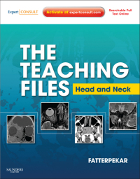 Cover image: The Teaching Files: Head and Neck Imaging - Electronic 1st edition 9781416060598