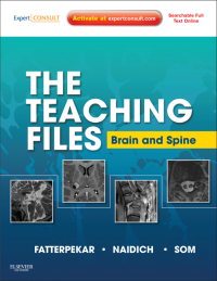 Cover image: The Teaching Files: Brain and Spine - Electronic 1st edition 9781416056201