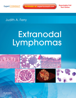 Cover image: Extranodal Lymphomas 9781416045793
