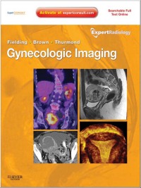 Cover image: Gynecologic Imaging 1st edition 9781437715750