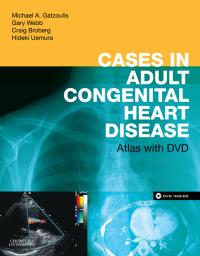 Immagine di copertina: Cases in Adult Congenital Heart Disease 9780443067129